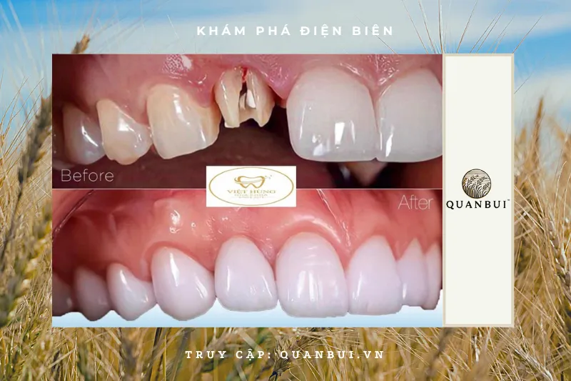 Nha khoa Việt Hùng